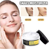 کرم حلزون کوزارکس