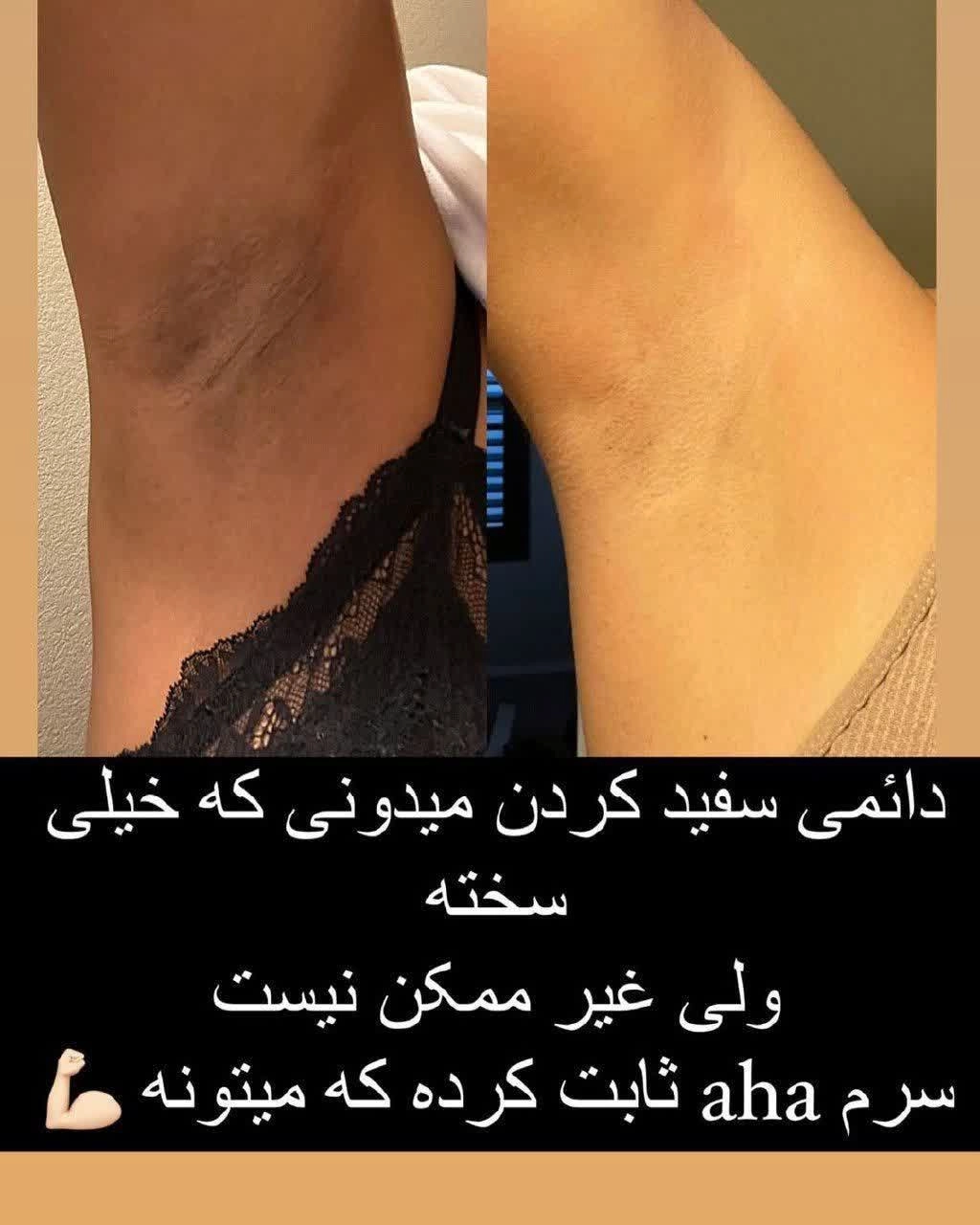 سرم روشن کننده AHA اورجینال